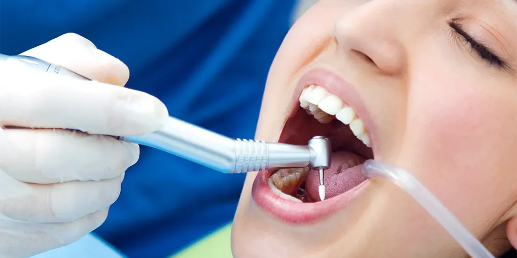 limpeza dental em São José dos Campos, agendamento fácil pela SoluMedi